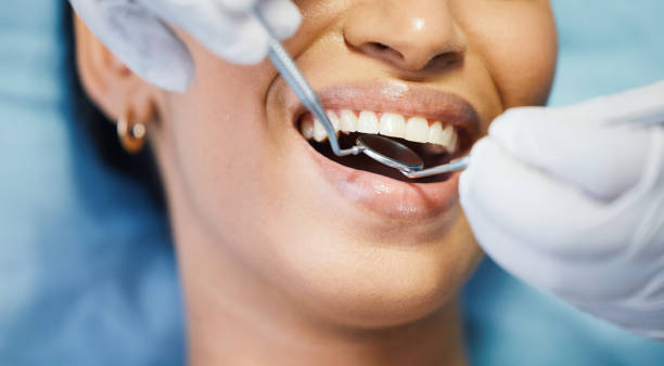 Best Emergency Treatment for Oral Infections in Belle Rose, LA